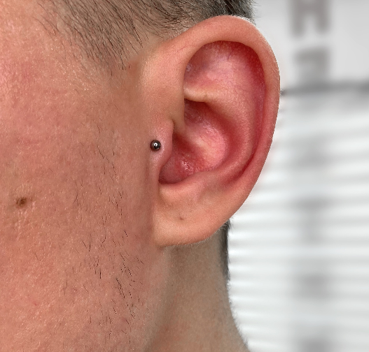 Пирсинг "трагус" с классическим лабретом