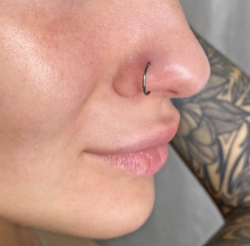 Зажившее крыло носа с классическим кольцом от Насти